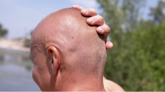 Checking Shaved Head for Irritation - Common Roundry Mistakes to Avoid for Irritation-Free Shaving