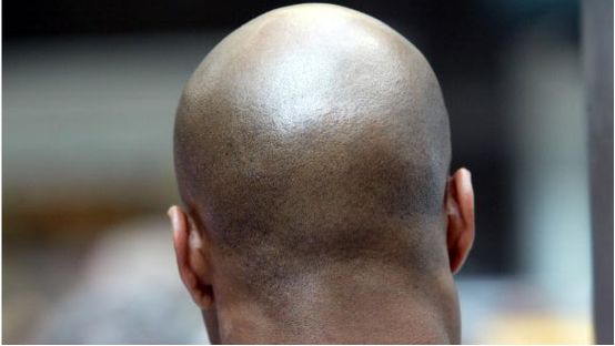 This smooth scalp is the result of using a head shaver matched to the user’s scalp type.