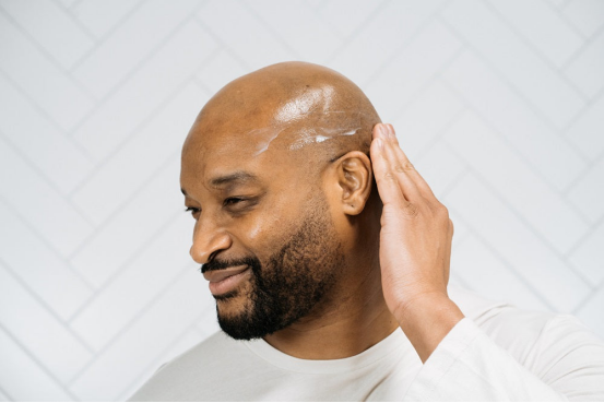 This man applies post-shave care after using a head shaver tailored to his scalp type.